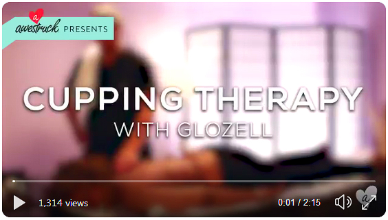 Glozell Tries Cupping